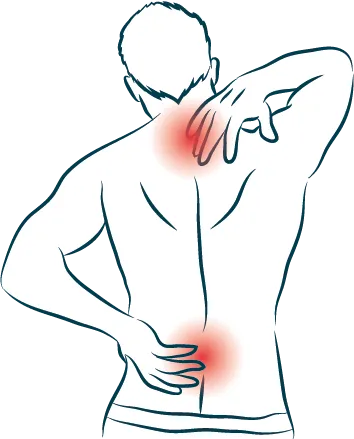 Hernia de disco Hernia de Disco